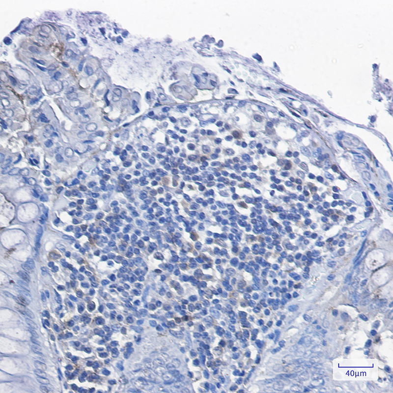 [KD]PKC delta Rabbit mAb ABZ4689