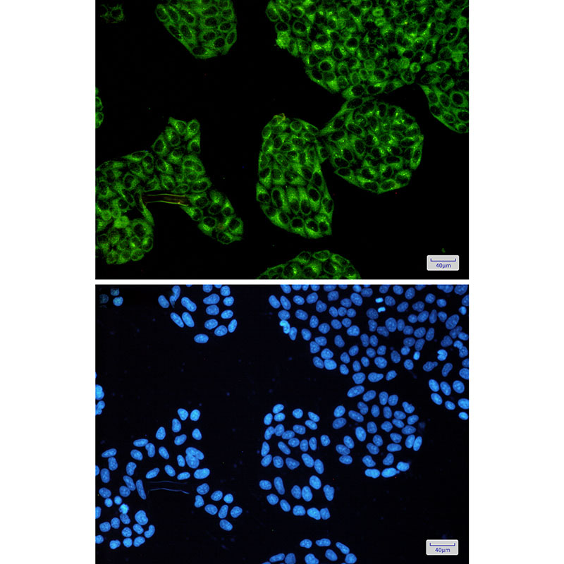 [KD]cAMP Protein Kinase Catalytic Subunit Rabbit mAb ABZ4690