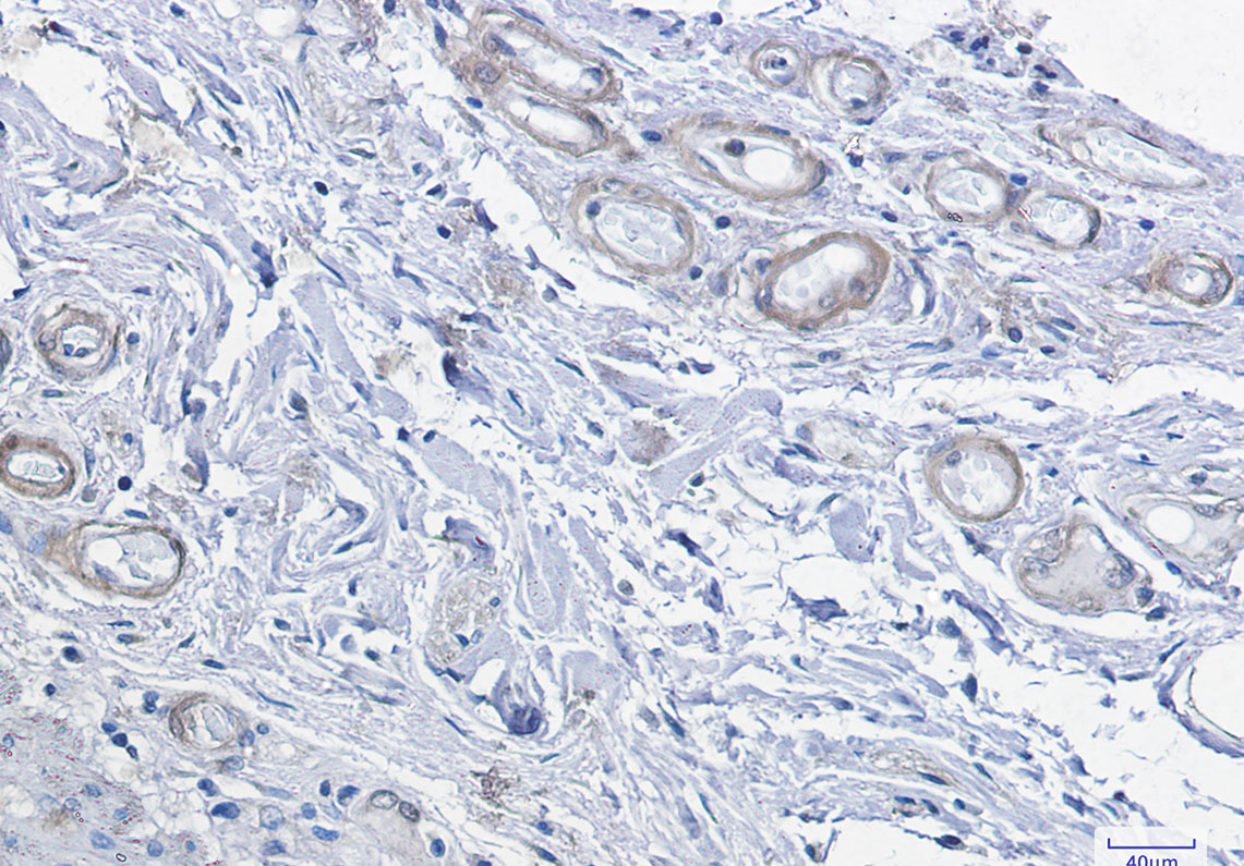 [KD]cAMP Protein Kinase Catalytic Subunit Rabbit mAb ABZ4690