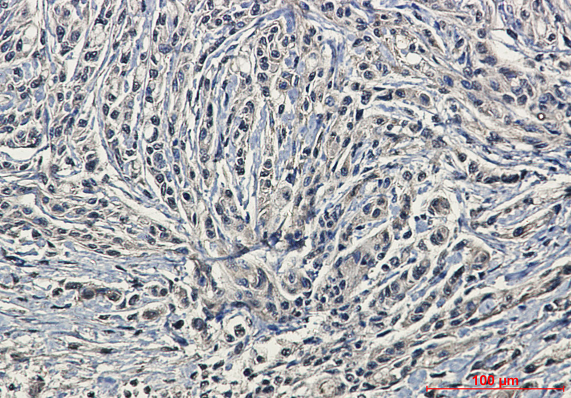 [KD]Phospho-PKC alpha (Ser657) Rabbit mAb ABZ4691