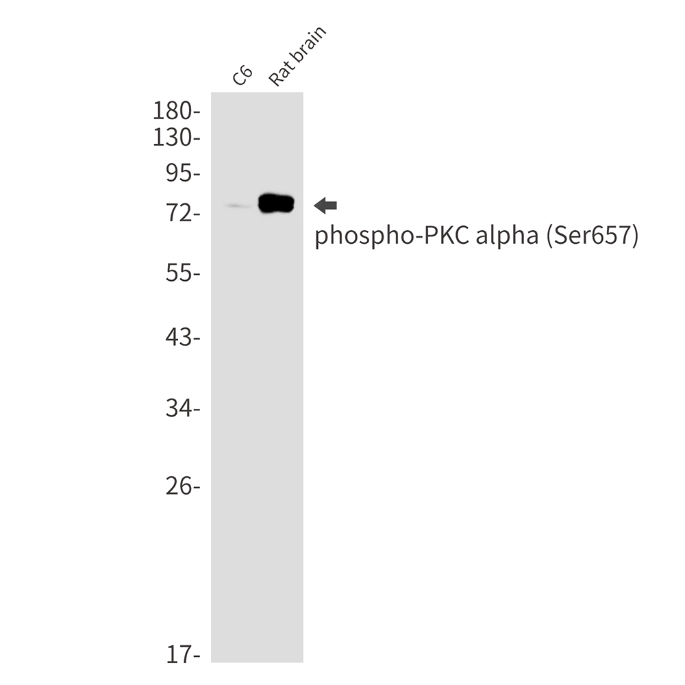 [KD]Phospho-PKC alpha (Ser657) Rabbit mAb ABZ4691