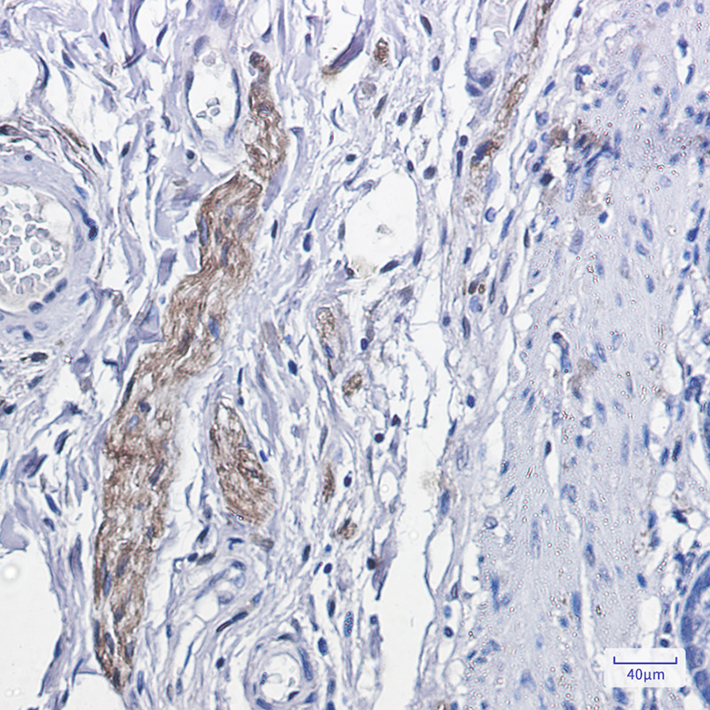 [KO]Phospho-PKC alpha (Thr638) Rabbit mAb ABZ4692