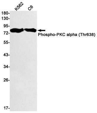 [KO]Phospho-PKC alpha (Thr638) Rabbit mAb ABZ4692