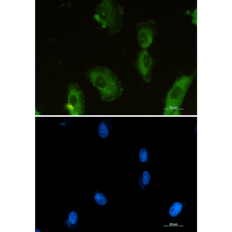 [KO]Aldolase Rabbit mAb ABZ4694