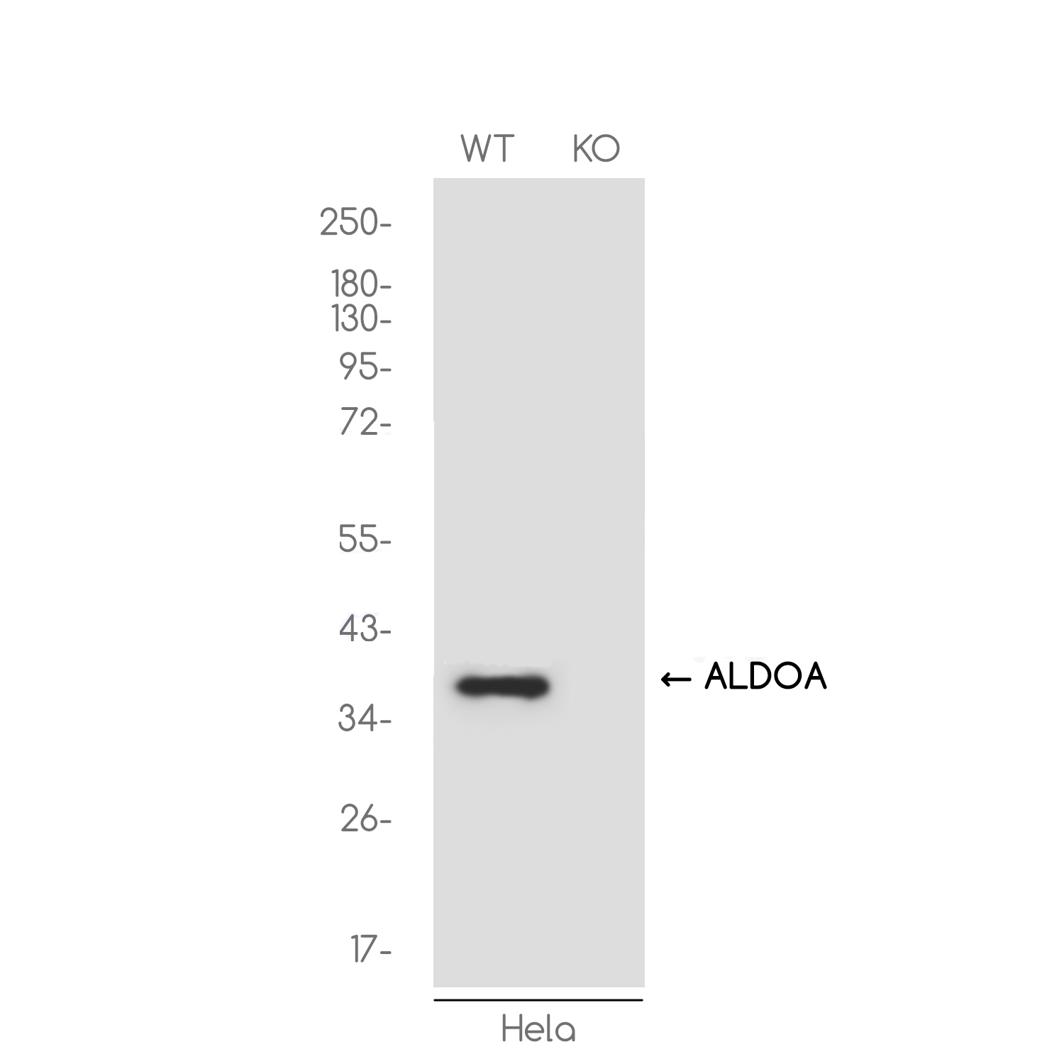 [KO]Aldolase Rabbit mAb ABZ4694