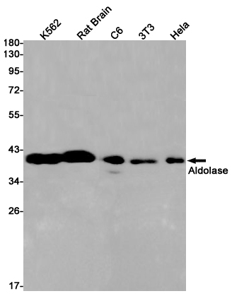 [KO]Aldolase Rabbit mAb ABZ4694