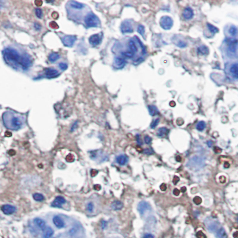 [KO]Catalase Rabbit mAb ABZ4695