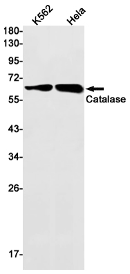[KO]Catalase Rabbit mAb ABZ4695