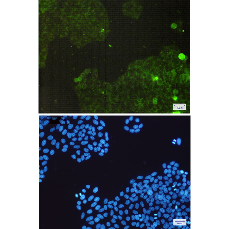 [KO]Catalase Rabbit mAb ABZ4696