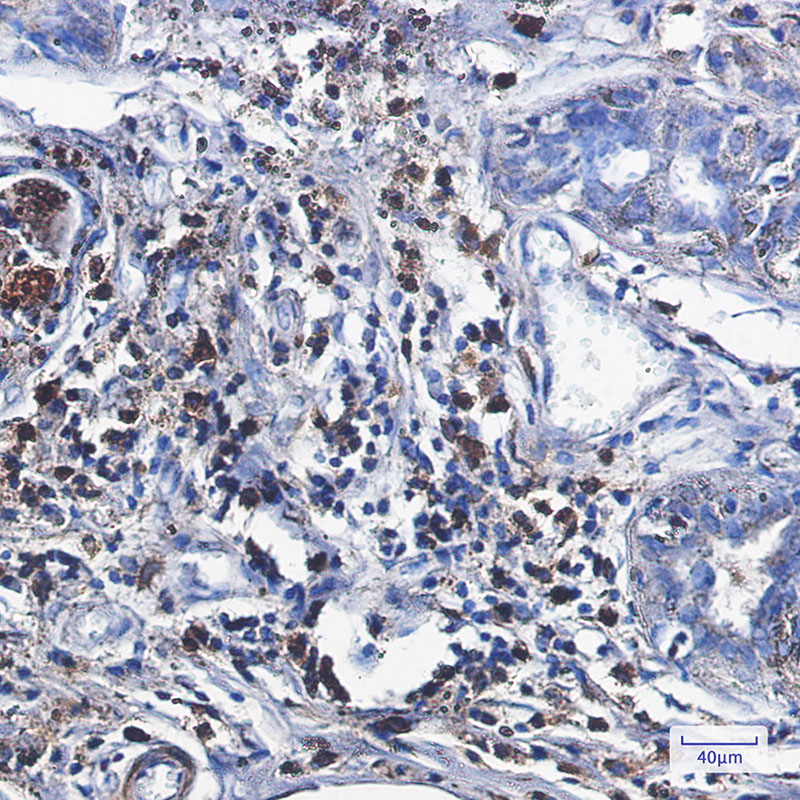 [KO]Catalase Rabbit mAb ABZ4696