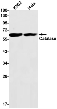 [KO]Catalase Rabbit mAb ABZ4696