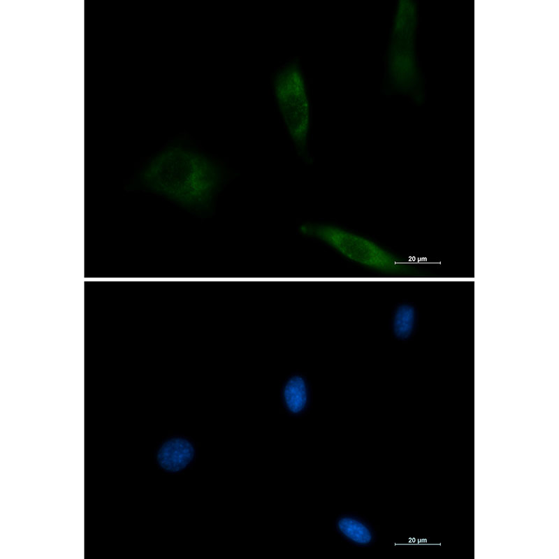 [KO]EGFR Rabbit mAb ABZ4697