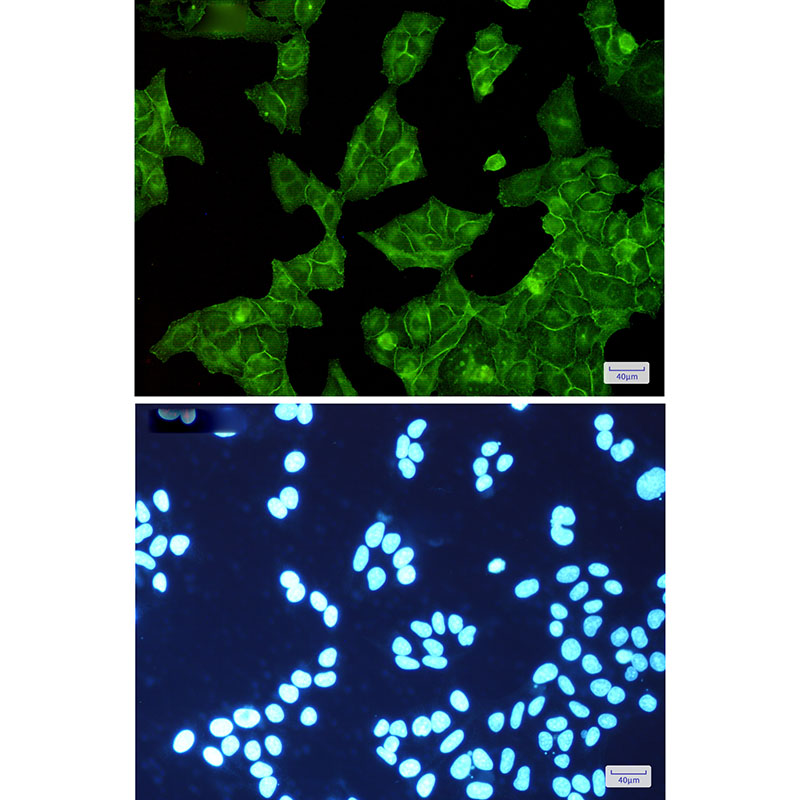 [KO]EGFR Rabbit mAb ABZ4698