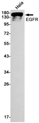 [KO]EGFR Rabbit mAb ABZ4698