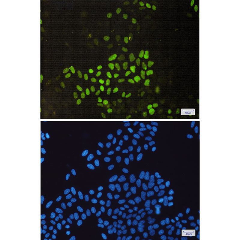 [KO]Cyclin E2 Rabbit mAb ABZ4699