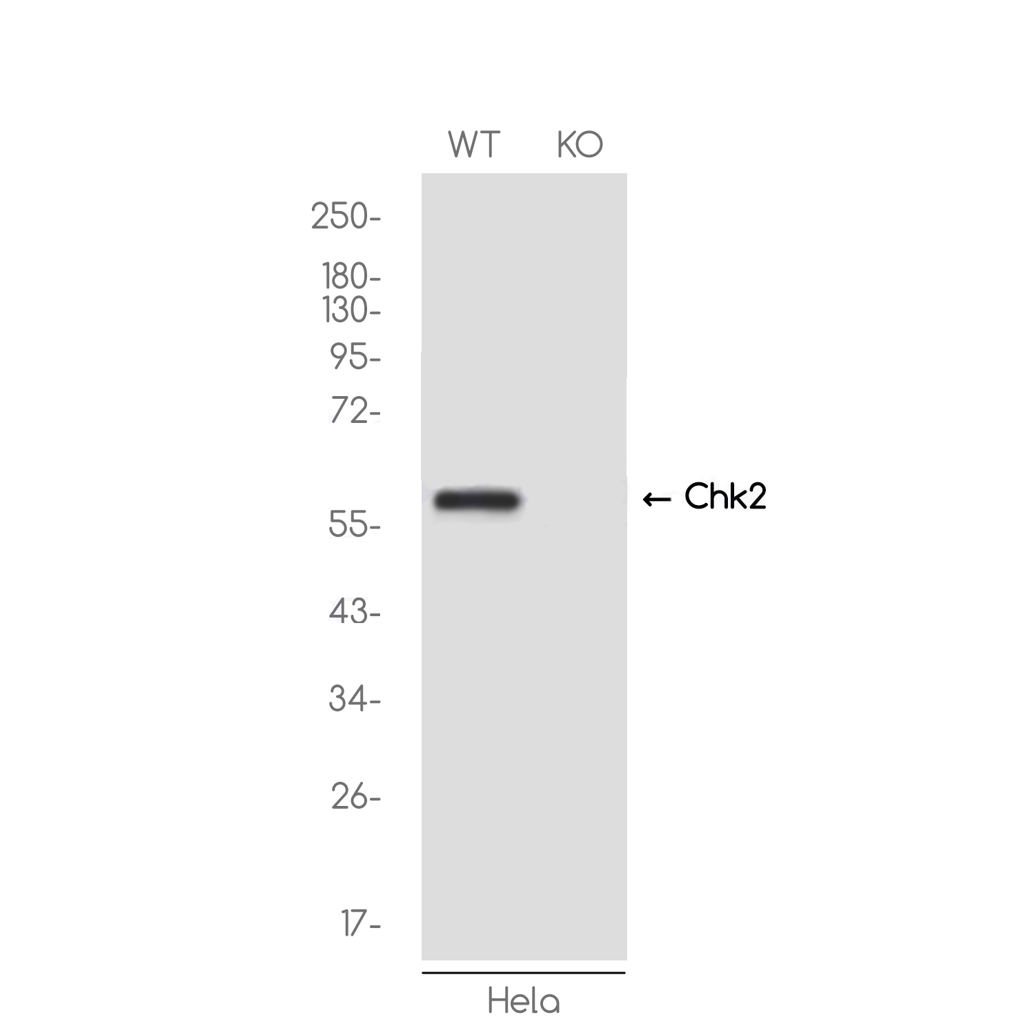 [KO]Chk2 Rabbit mAb ABZ4700
