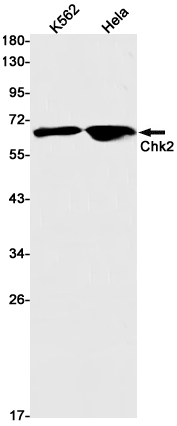 [KO]Chk2 Rabbit mAb ABZ4700