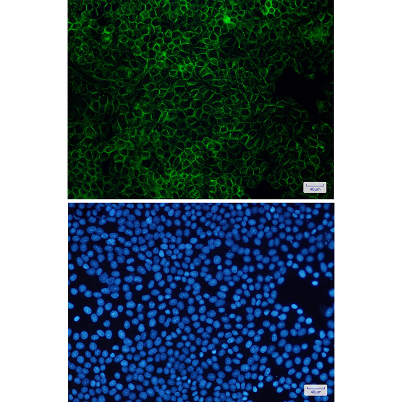 [KD]Flotillin 1 Rabbit mAb ABZ4701