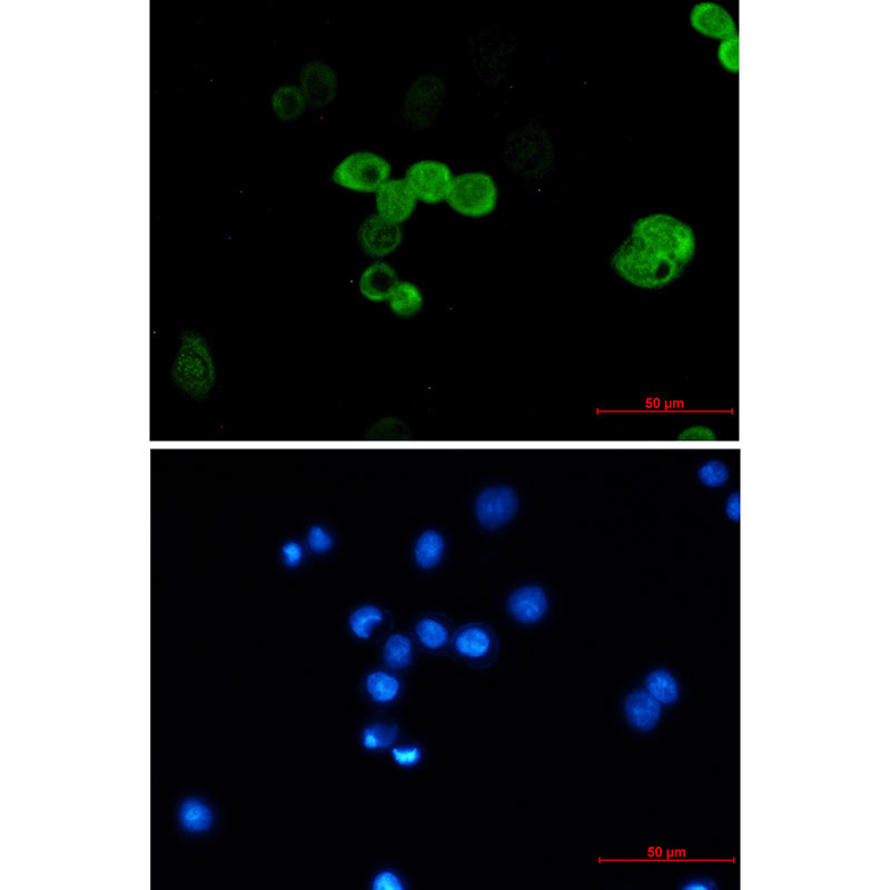 [KO]CRABP2 Rabbit mAb ABZ4704