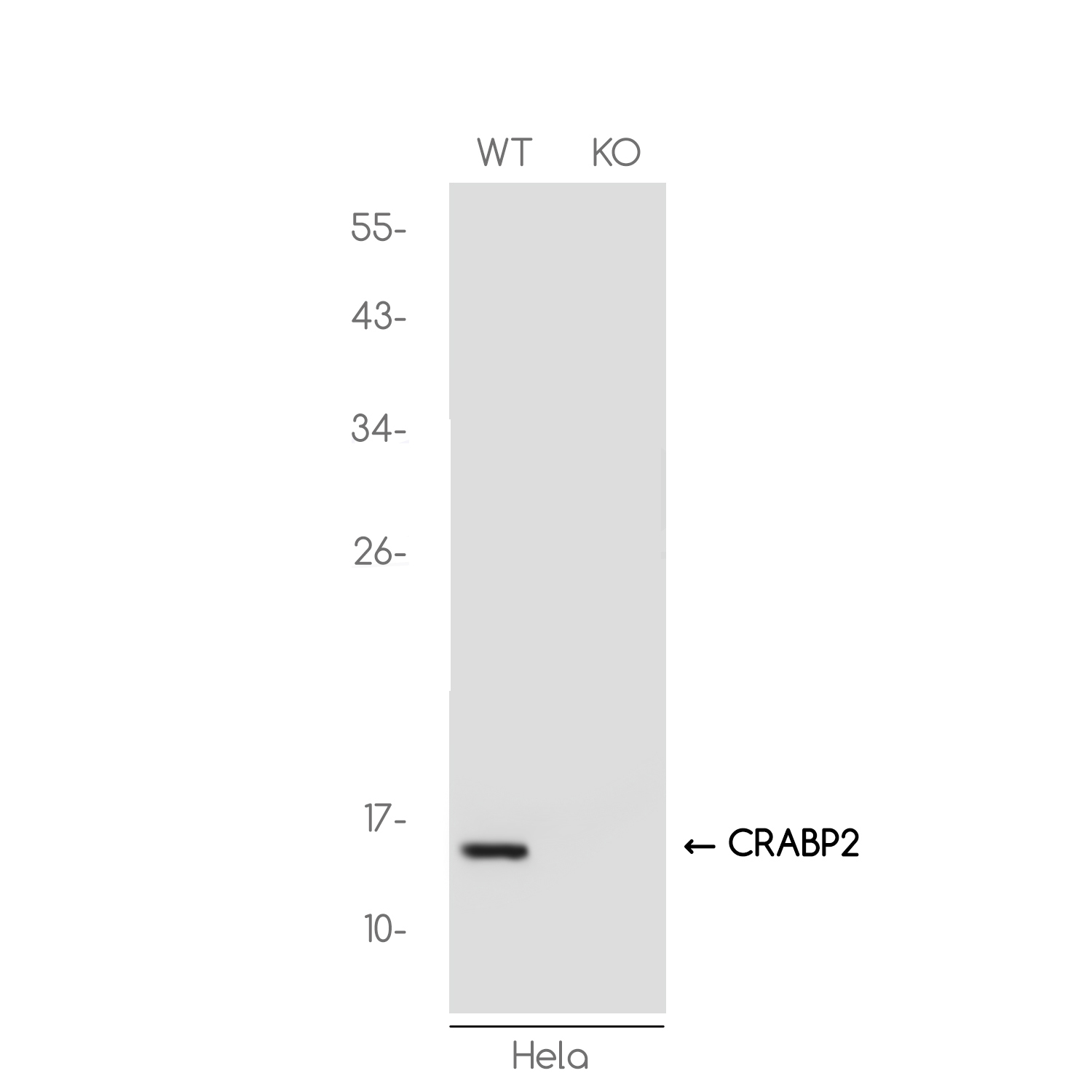 [KO]CRABP2 Rabbit mAb ABZ4704