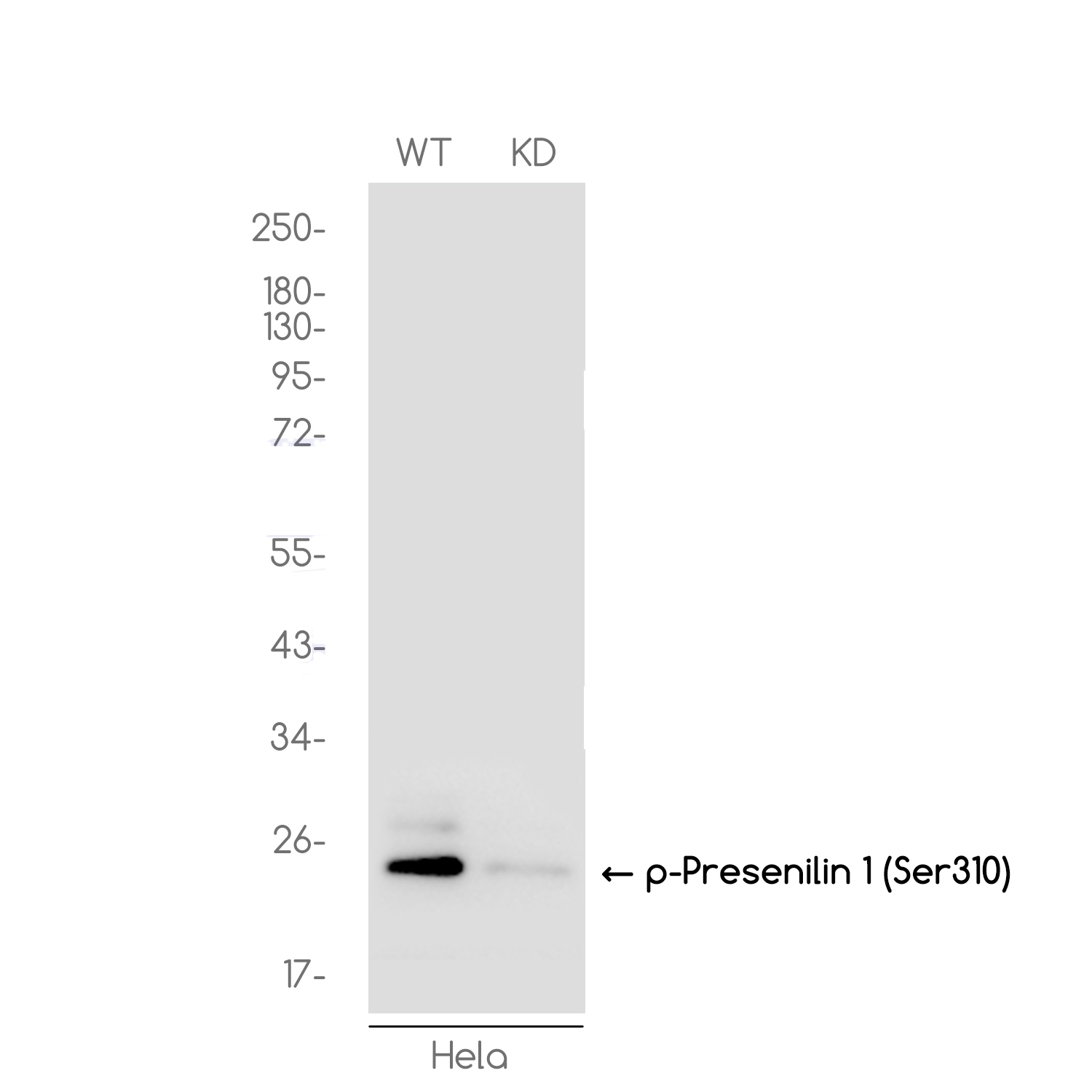 [KD]Phospho-Presenilin 1 (Ser310) Rabbit mAb ABZ4707