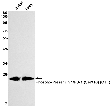 [KD]Phospho-Presenilin 1 (Ser310) Rabbit mAb ABZ4707