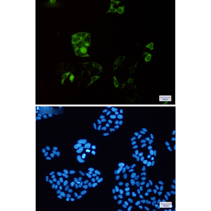 [KD]Cyclin B1 Rabbit mAb ABZ4708