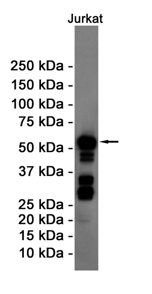 [KD]Cyclin B1 Rabbit mAb ABZ4708