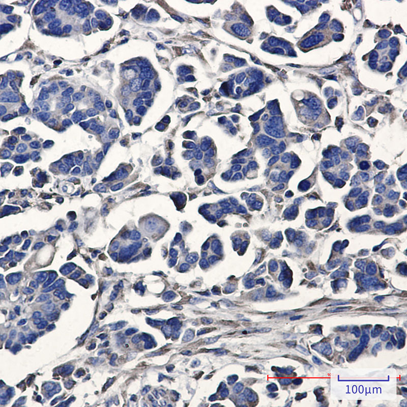 [KO]ATE1 Rabbit mAb ABZ4710