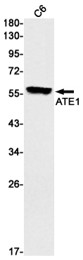 [KO]ATE1 Rabbit mAb ABZ4710