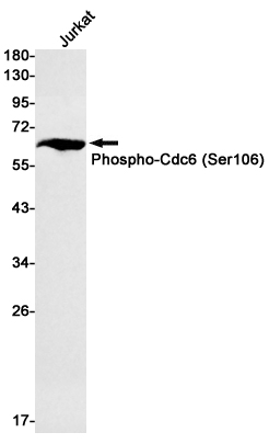 [KD]Phospho-CDC6 (Ser106) Rabbit mAb ABZ4712