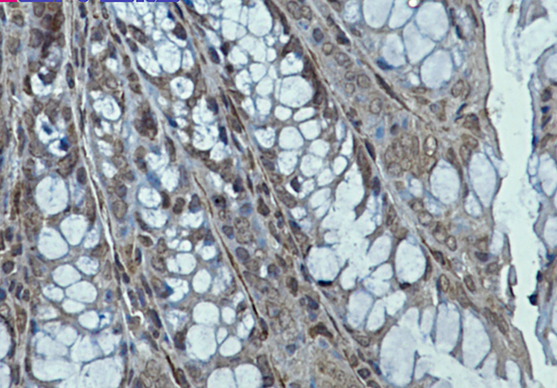 [KD]Creatine Kinase B type Rabbit mAb ABZ4713
