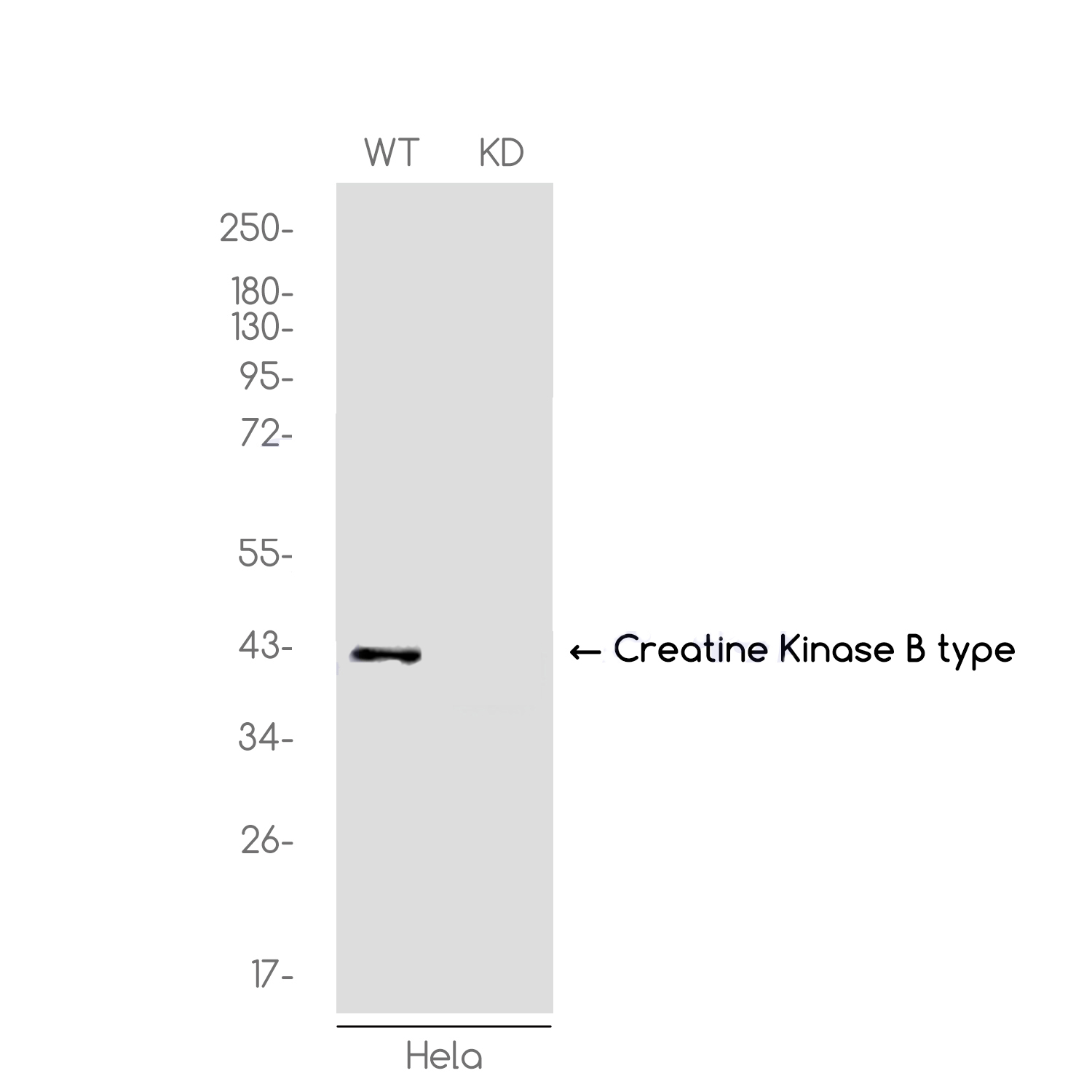 [KD]Creatine Kinase B type Rabbit mAb ABZ4714