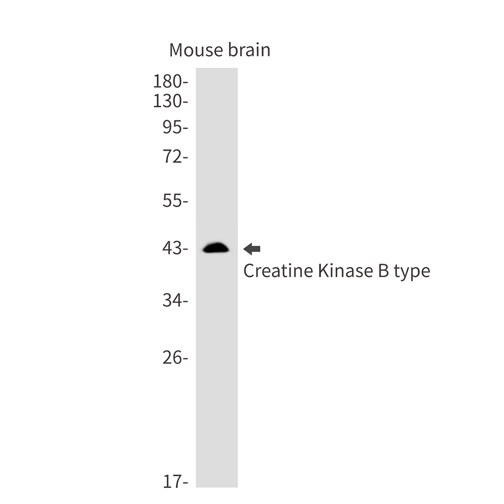 [KD]Creatine Kinase B type Rabbit mAb ABZ4714