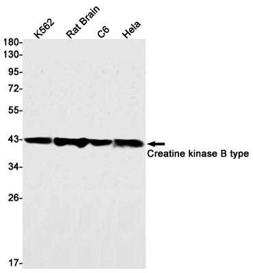 [KD]Creatine Kinase B type Rabbit mAb ABZ4714