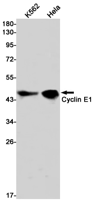[KD]Cyclin E1 Rabbit mAb ABZ4715