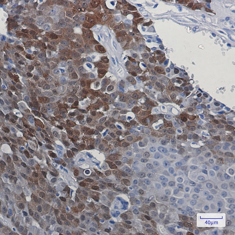 [KD]DARPP32 Rabbit mAb ABZ4716