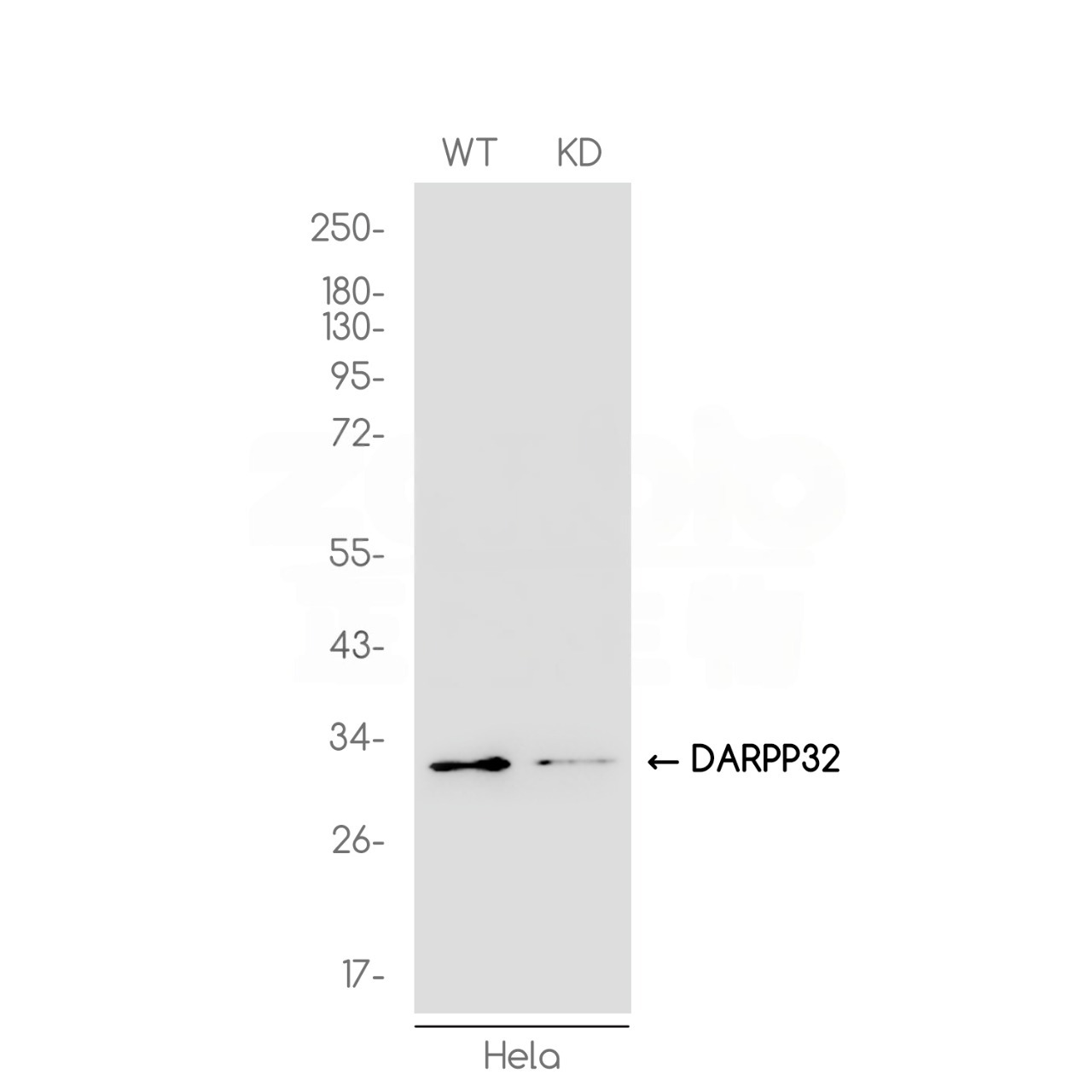 [KD]DARPP32 Rabbit mAb ABZ4716