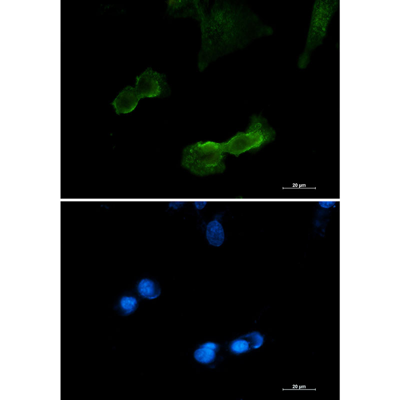 [KD]DCAMKL1 Rabbit mAb ABZ4717