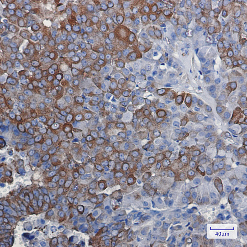[KD]DCAMKL1 Rabbit mAb ABZ4717