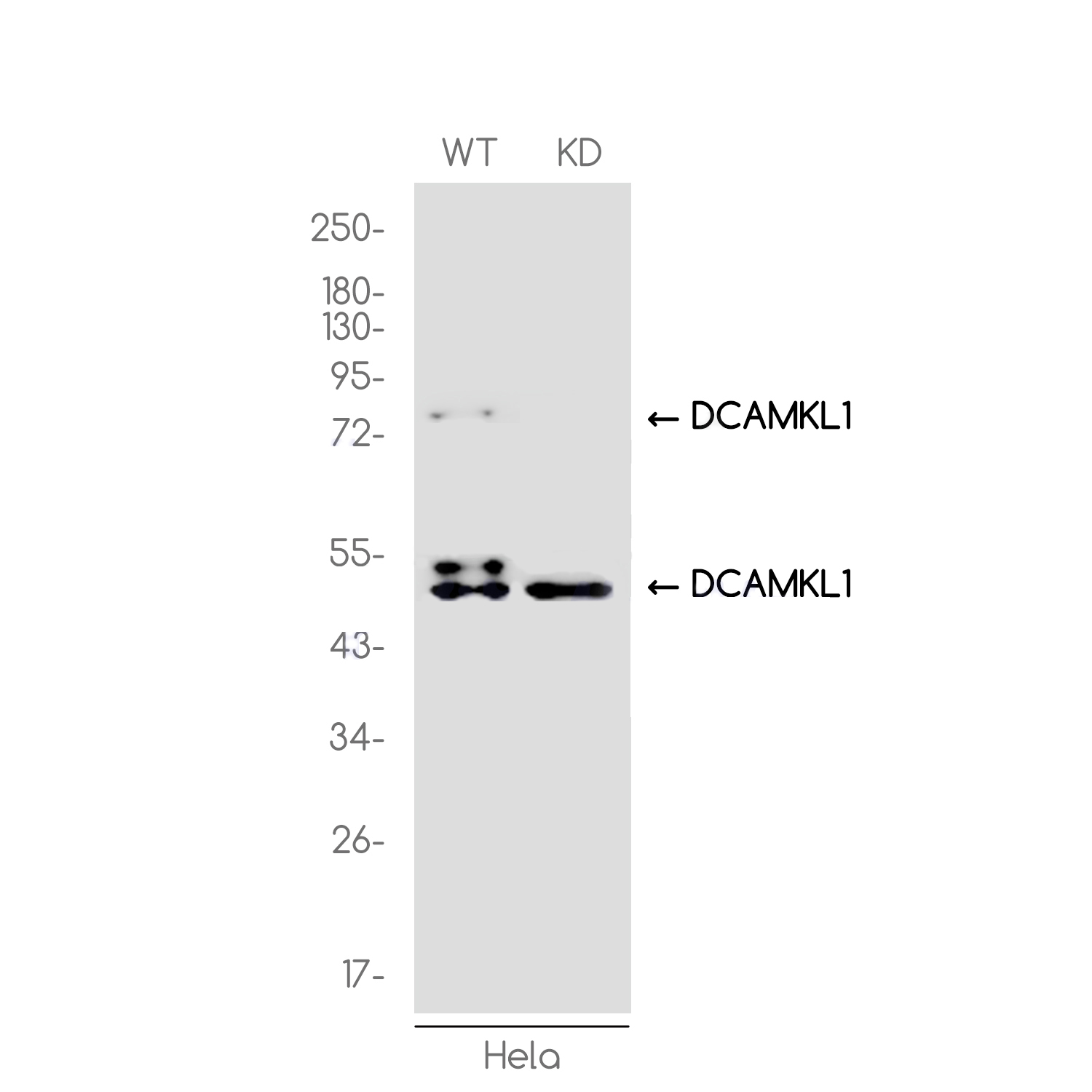 [KD]DCAMKL1 Rabbit mAb ABZ4717
