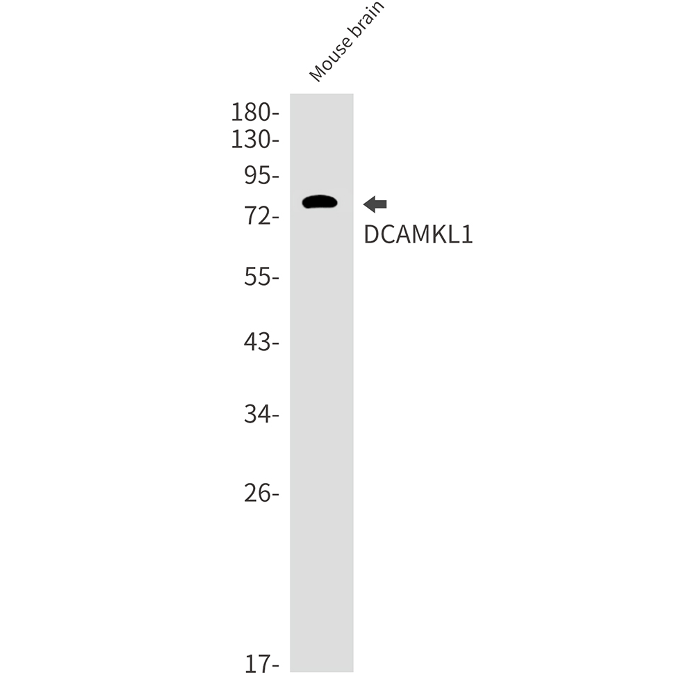 [KD]DCAMKL1 Rabbit mAb ABZ4717