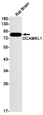 [KD]DCAMKL1 Rabbit mAb ABZ4717