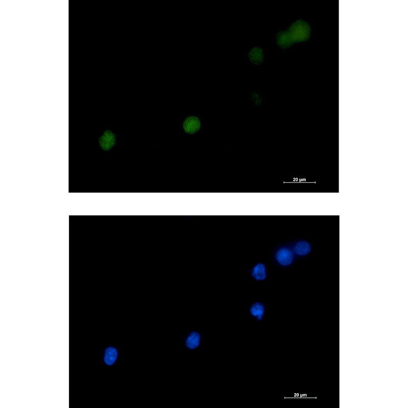 [KD]DKC1 Rabbit mAb ABZ4718