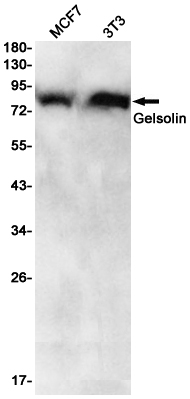 [KD]Gelsolin Rabbit mAb ABZ4719