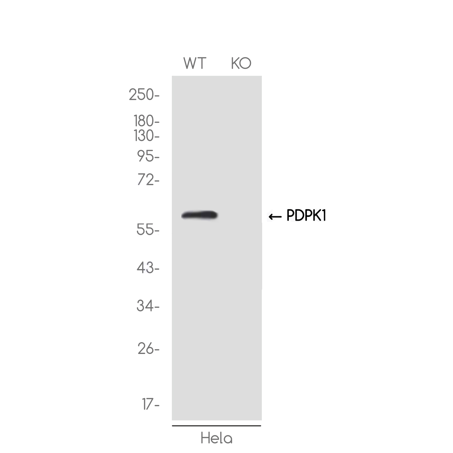 [KO]PDPK1 Rabbit mAb ABZ4722