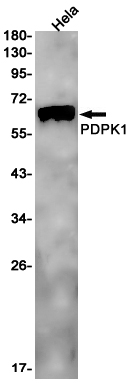 [KO]PDPK1 Rabbit mAb ABZ4722