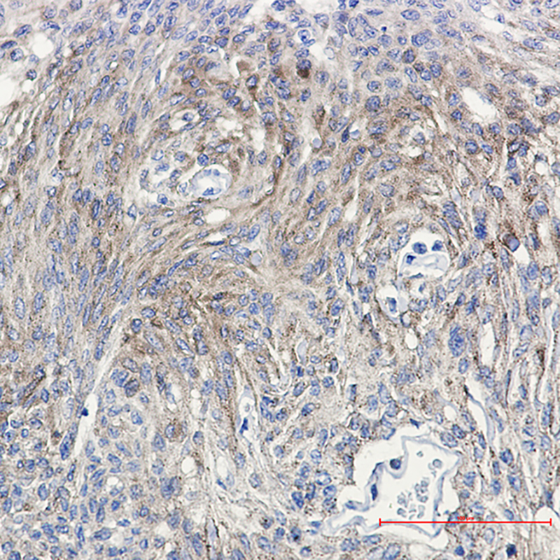 [KD]Phospho-PKC gamma (Thr514) Rabbit mAb ABZ4723