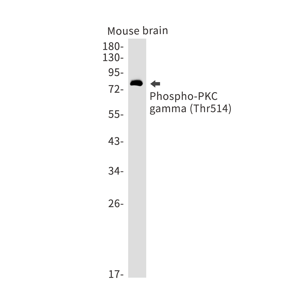 [KD]Phospho-PKC gamma (Thr514) Rabbit mAb ABZ4723