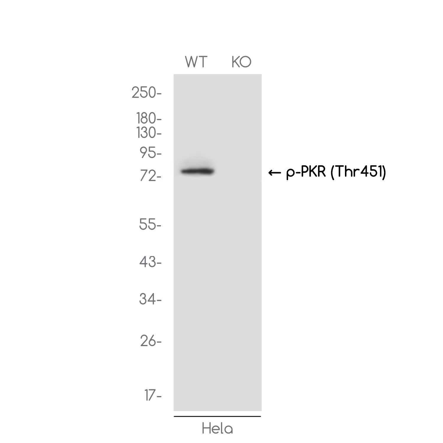 [KO]Phospho-PKR (Thr451) Rabbit mAb ABZ4724
